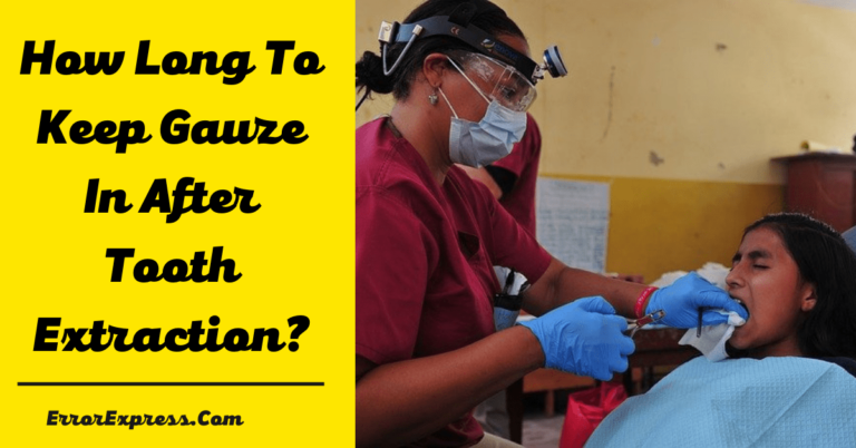 Feature Image For How Long To Keep Gauze In After Tooth Extraction