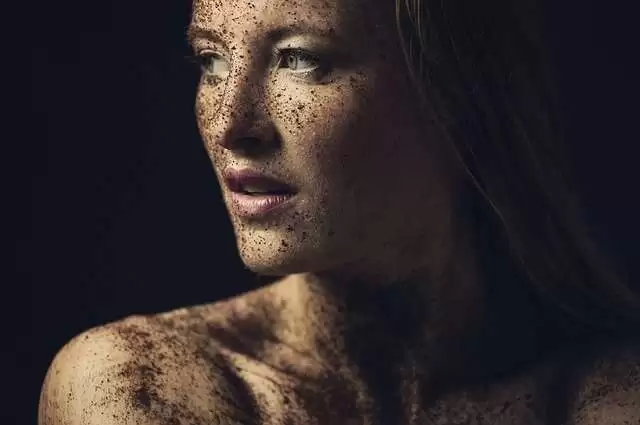 The girl diffrent skin