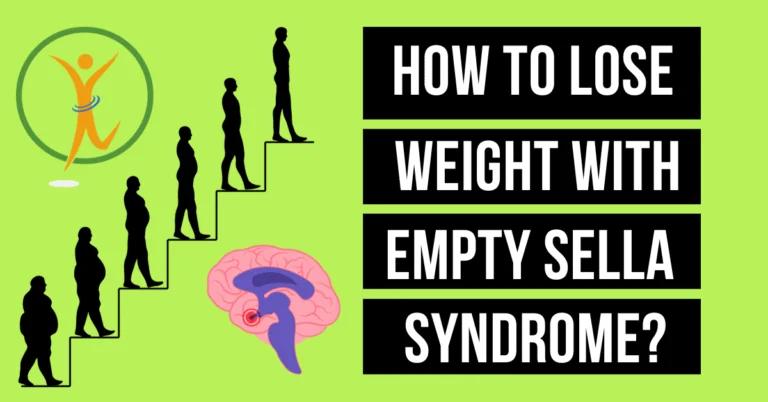 How To Lose Weight With Empty Sella Syndrome