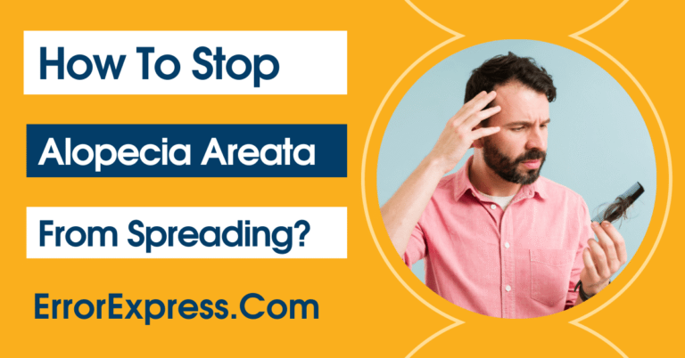 How To Stop Alopecia Areata From Spreading