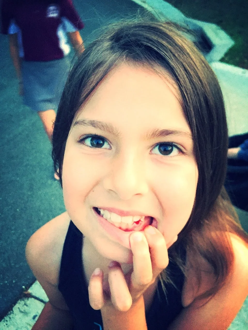 How to Reduce Gap Between Teeth Naturally at Home